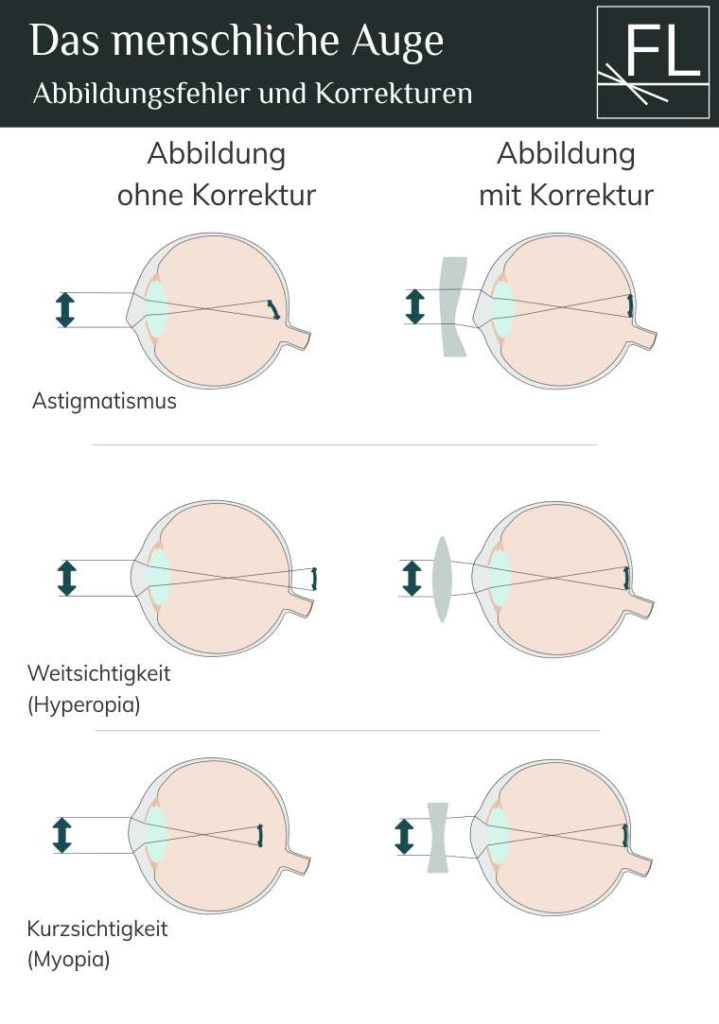 Das Menschliche Auge – Aufbau Und Funktion – Fokuspunkt.licht serapportantà Aufbau Auge Grundschule